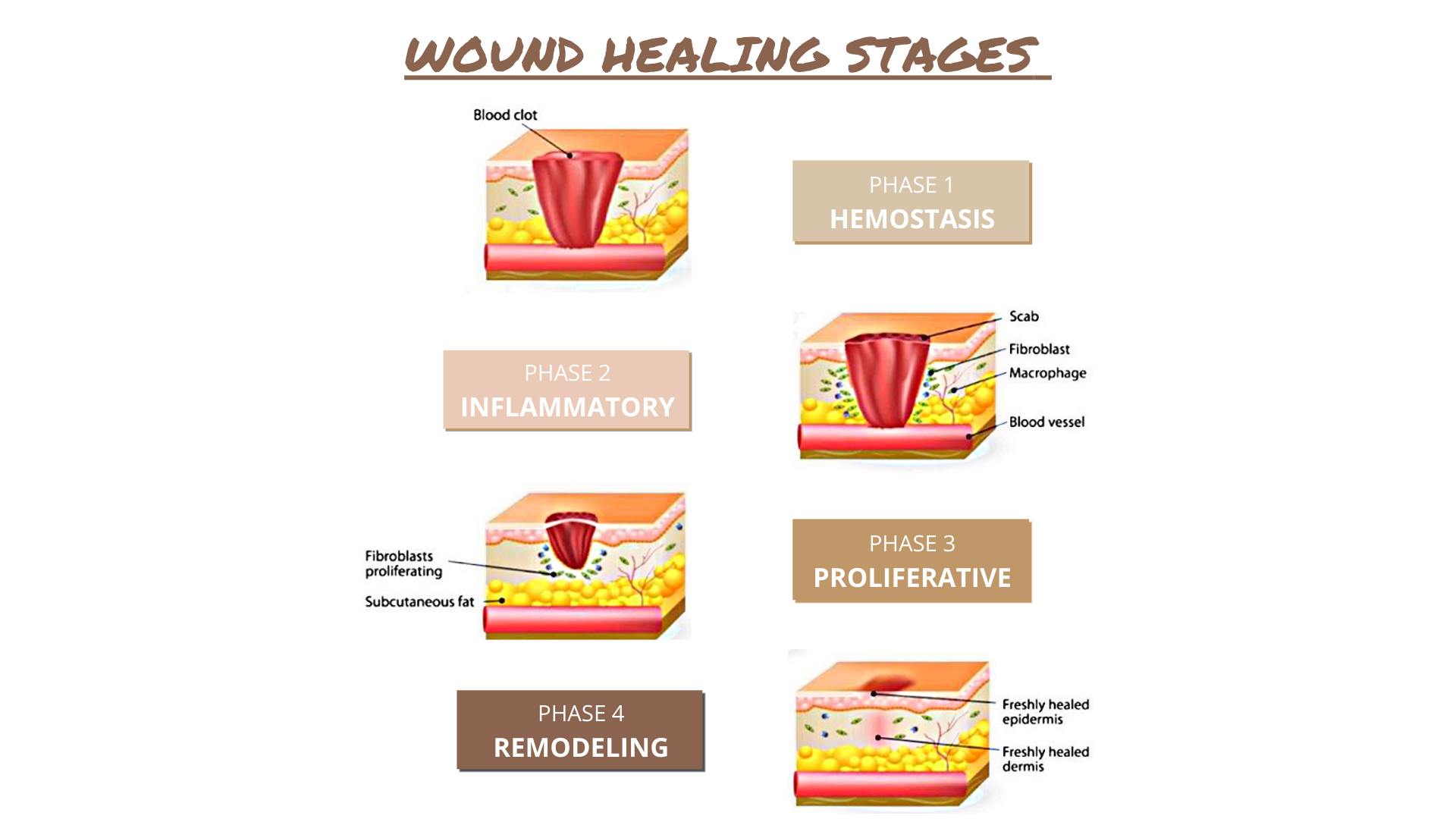 wound healing process