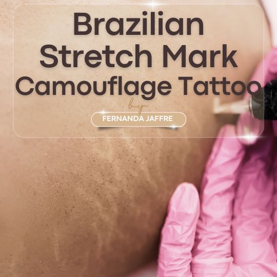 Stretch Mark Camouflage: What You Should Know Before Concealing Your Stretch Marks